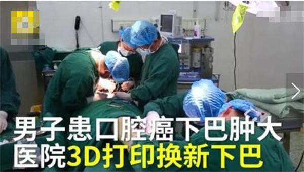 “医生用3D打印为患者换下新下巴”上了微博热搜？这是怎么回事？！