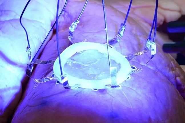 如何在扩张的肺部上3D打印一个柔性医疗传感器？